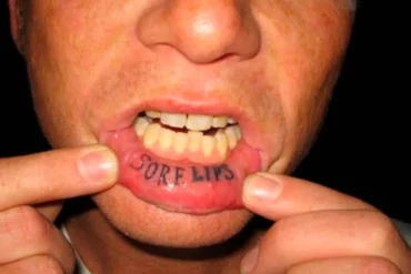 EPICLY LATER’D par Patrick O’Dell